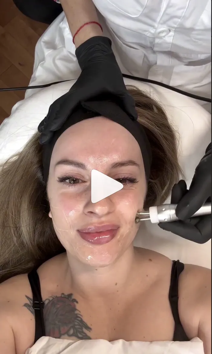 Skin treatment procedure reel